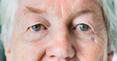 Signs of Aging Eyes You Shouldn’t Ignore