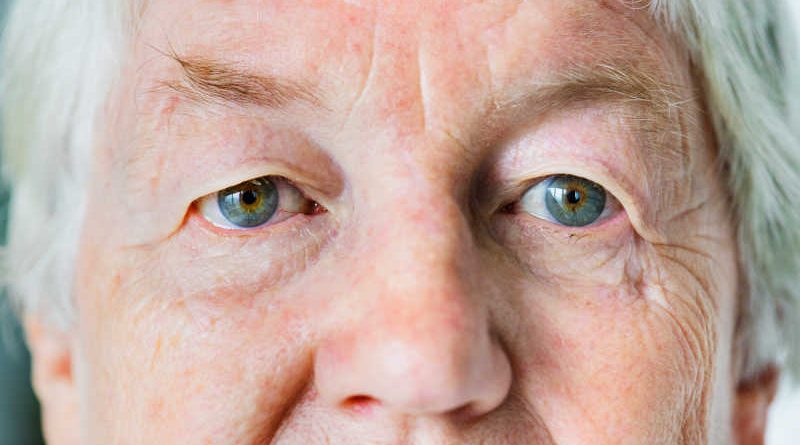 Signs of Aging Eyes You Shouldn’t Ignore